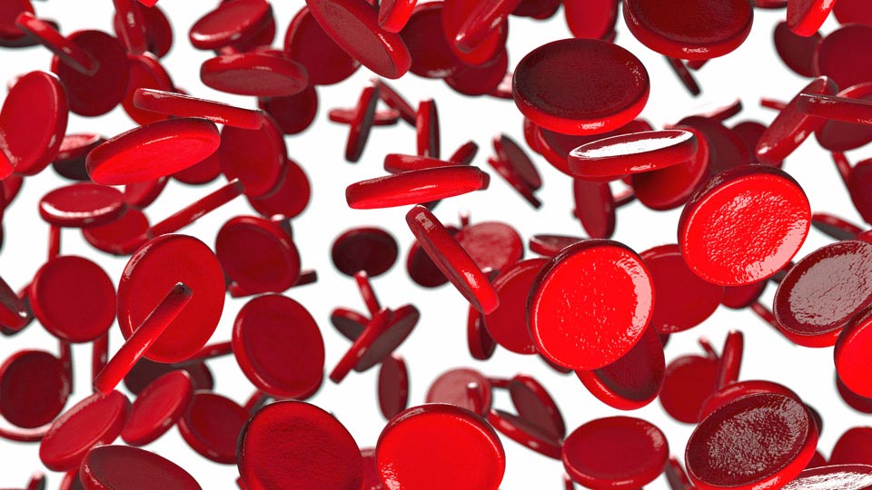 Haemophilia breakthrough 血友病治疗方法的重大突破